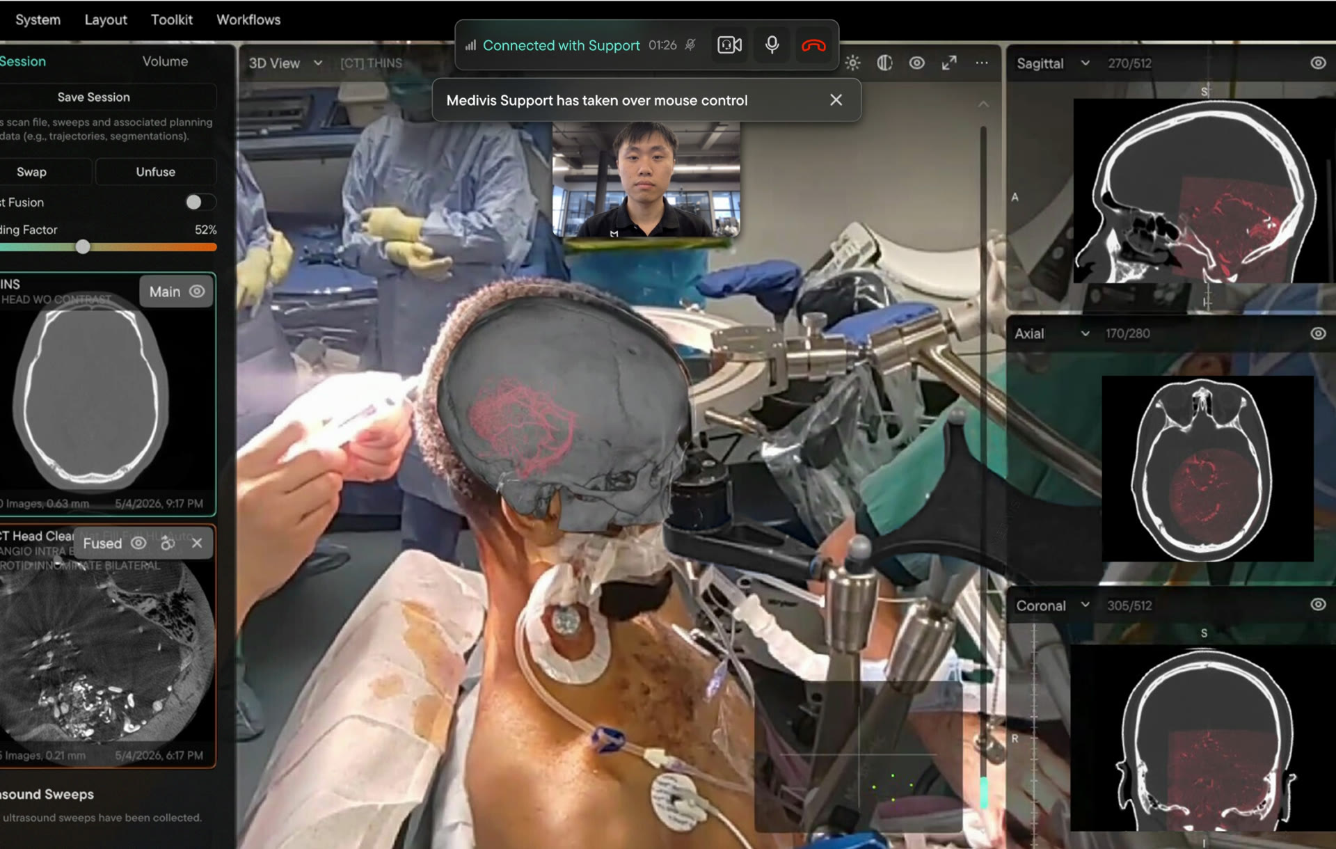 Remote-Support mit einem Klick in Medivis Studio