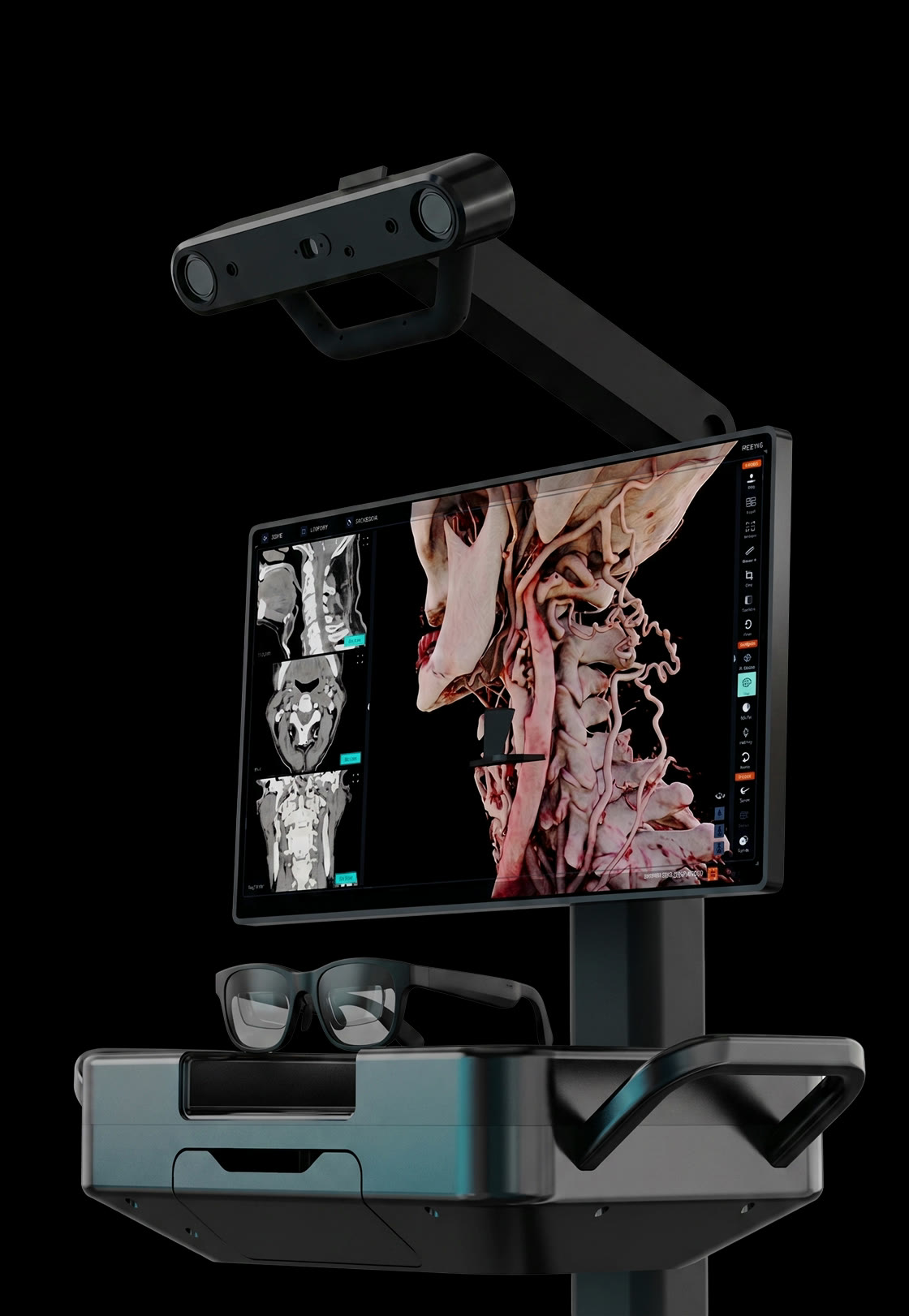 La station de travail Medivis — tracker infrarouge, affichage spatial et lunettes AR sur un seul chariot